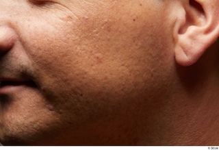 HD Face Skin Mariano Atenas cheek ear face skin pores…